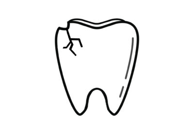 I Chipped a Tooth! What Can I Do? | Dentist in Topeka
